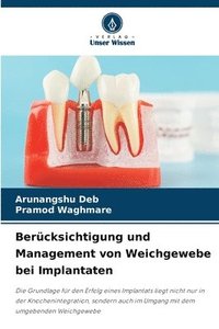 bokomslag Berücksichtigung und Management von Weichgewebe bei Implantaten
