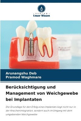 Arunangshu Deb, Pramod Waghmare - Berücksichtigung und Management von Weichgewebe bei Implantaten, Häftad
