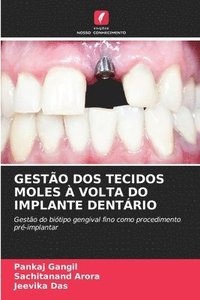 bokomslag GESTÃO DOS TECIDOS MOLES À VOLTA DO IMPLANTE DENTÁRIO