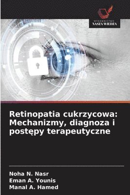 bokomslag Retinopatia cukrzycowa