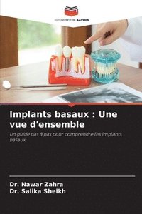 bokomslag Implants basaux
