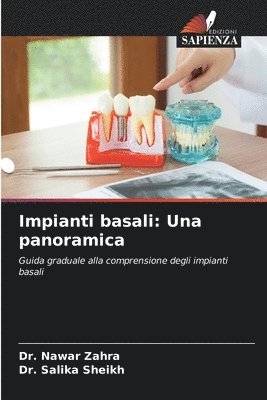 bokomslag Impianti basali: Una panoramica