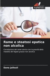 bokomslag Rame e steatosi epatica non alcolica