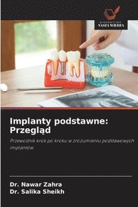 bokomslag Implanty podstawne