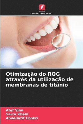 bokomslag Otimização do ROG através da utilização de membranas de titânio