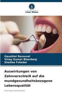 bokomslag Auswirkungen von Zahnverschleiß auf die mundgesundheitsbezogene Lebensqualität