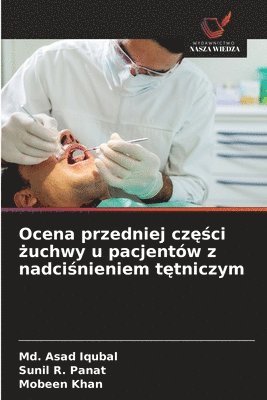MD Asad Iqubal, Sunil R Panat, Mobeen Khan - Ocena przedniej części żuchwy u pacjentów z nadciśnieniem tętniczym, Häftad