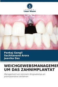 bokomslag Weichgewebsmanagement Um Das Zahnimplantat