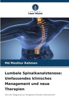 bokomslag Lumbale Spinalkanalstenose: Umfassendes klinisches Management und neue Therapien