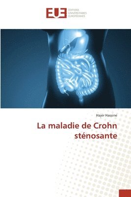 maladie de Crohn sténosante