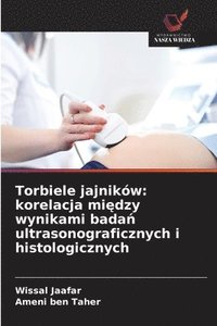 bokomslag Torbiele jajników: korelacja mi¿dzy wynikami bada¿ ultrasonograficznych i histologicznych