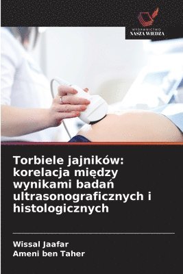 bokomslag Torbiele jajników