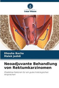 bokomslag Neoadjuvante Behandlung von Rektumkarzinomen