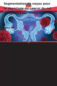 bokomslag Segmentation du noyau pour le dépistage du cancer du col de l'utérus par frottis cervical