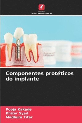 bokomslag Componentes protticos do implante