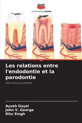 Ayush Goyal, John V George, Ritu Singh - Les relations entre l'endodontie et la parodontie, Häftad