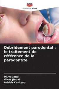 bokomslag Débridement parodontal: le traitement de référence de la parodontite