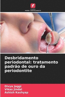 Desbridamento periodontal: tratamento padrão de ouro da periodontite 1