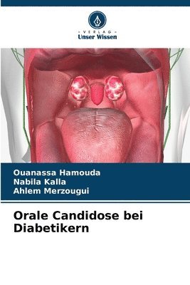 Orale Candidose bei Diabetikern 1