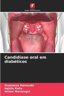 bokomslag Candidase oral em diabticos