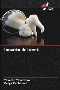 bokomslag Impatto dei denti