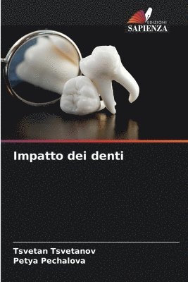 bokomslag Impatto dei denti