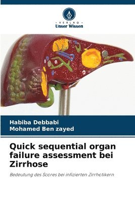 bokomslag Quick sequential organ failure assessment bei Zirrhose