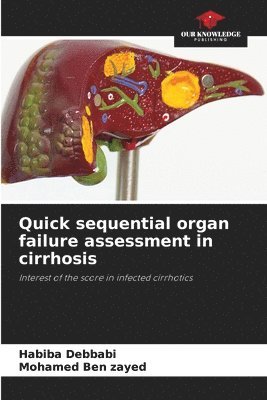 bokomslag Quick sequential organ failure assessment in cirrhosis