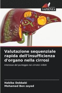 bokomslag Valutazione sequenziale rapida dell'insufficienza d'organo nella cirrosi