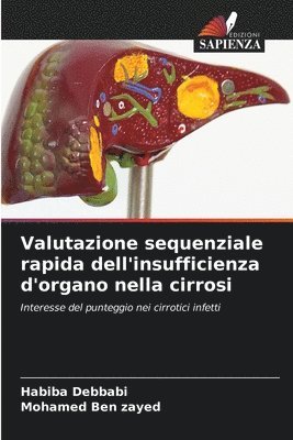 bokomslag Valutazione sequenziale rapida dell'insufficienza d'organo nella cirrosi