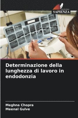 bokomslag Determinazione della lunghezza di lavoro in endodonzia