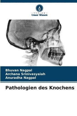 bokomslag Pathologien des Knochens