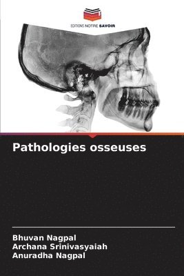 Pathologies osseuses 1