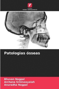 bokomslag Patologias ósseas