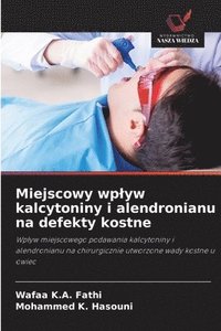 bokomslag Miejscowy wplyw kalcytoniny i alendronianu na defekty kostne