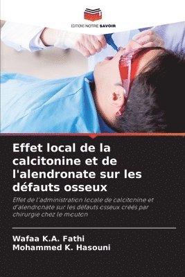 bokomslag Effet local de la calcitonine et de l'alendronate sur les défauts osseux