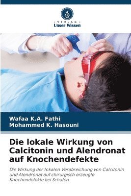 bokomslag lokale Wirkung von Calcitonin und Alendronat auf Knochendefekte