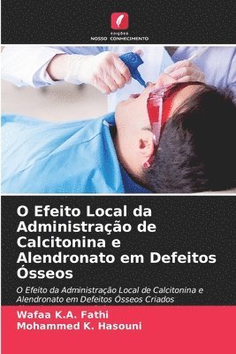 bokomslag O Efeito Local da Administração de Calcitonina e Alendronato em Defeitos Ósseos