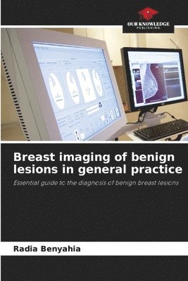 bokomslag Breast imaging of benign lesions in general practice