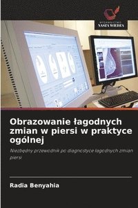 bokomslag Obrazowanie lagodnych zmian w piersi w praktyce oglnej