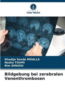 bokomslag Bildgebung bei zerebralen Venenthrombosen