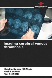 bokomslag Imaging cerebral venous thrombosis