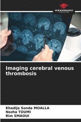 Imaging cerebral venous thrombosis 1