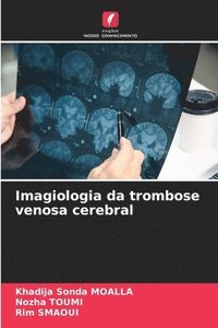 bokomslag Imagiologia da trombose venosa cerebral