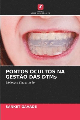Sanket Gavade, SANKET GAVADE - PONTOS OCULTOS NA GESTÃO DAS DTMs, Häftad