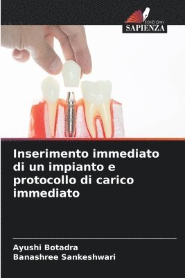 Ayushi Botadra, Banashree Sankeshwari - Inserimento immediato di un impianto e protocollo di carico immediato, Häftad