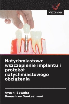 bokomslag Natychmiastowe wszczepienie implantu i protokl natychmiastowego obci&#261;&#380;enia