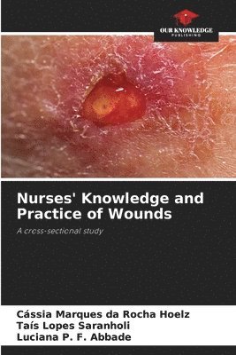 Cássia Marques Da Rocha Hoelz, Taís Lopes Saranholi, Luciana P F Abbade, Cássia Marques da Rocha Hoelz, Luciana P. F. Abbade - Nurses' Knowledge and Practice of Wounds, Häftad