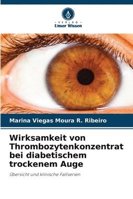 bokomslag Wirksamkeit von Thrombozytenkonzentrat bei diabetischem trockenem Auge