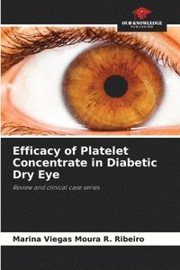 bokomslag Efficacy of Platelet Concentrate in Diabetic Dry Eye